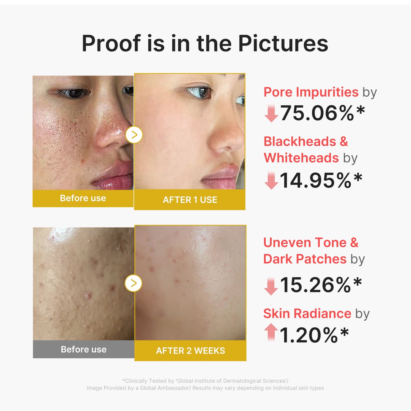 kojic-acid-turmeric-peel-shot-j3 02_45fe66d3-b3f6-4100-aa52-2afd7eded417.jpg