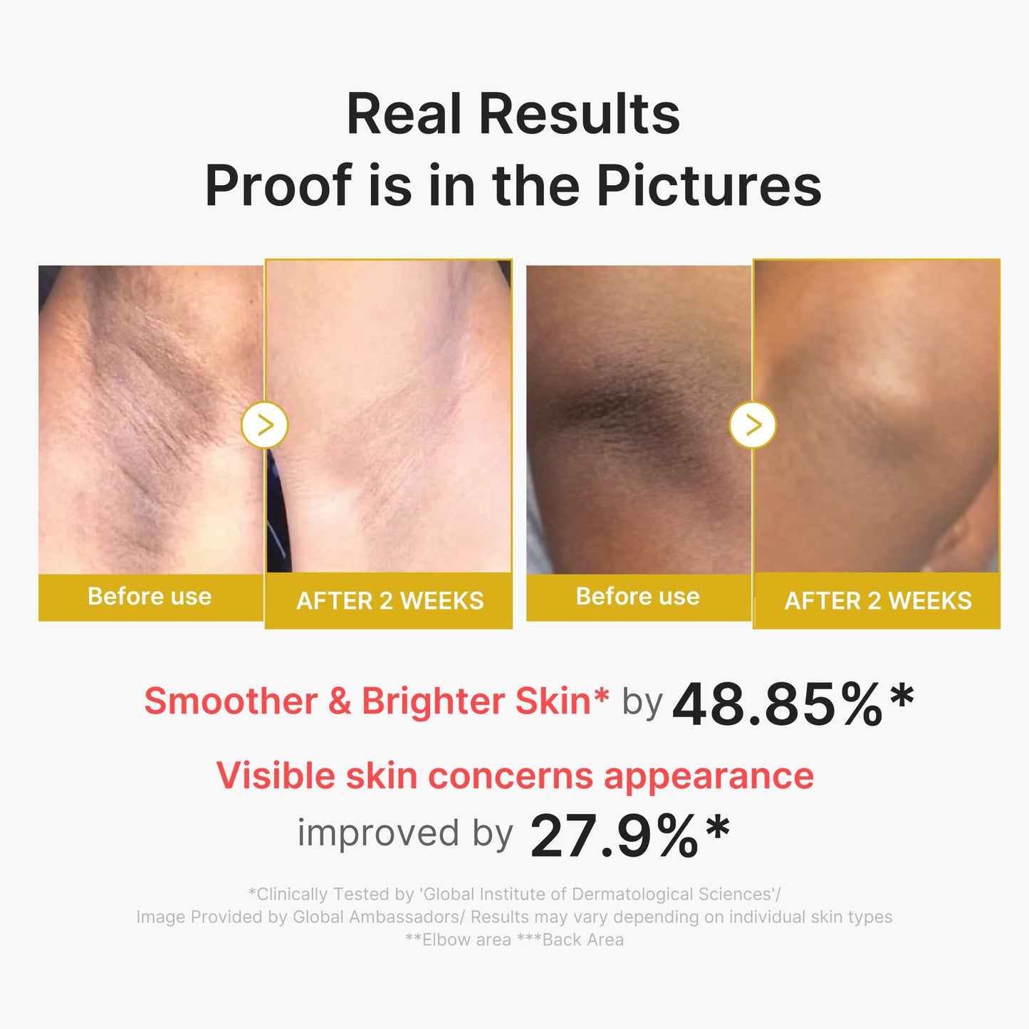 kojic-acid-turmeric-body-peel-shot-z7 02_72880cfc-382b-440b-8152-7e3dce87da2a.jpg