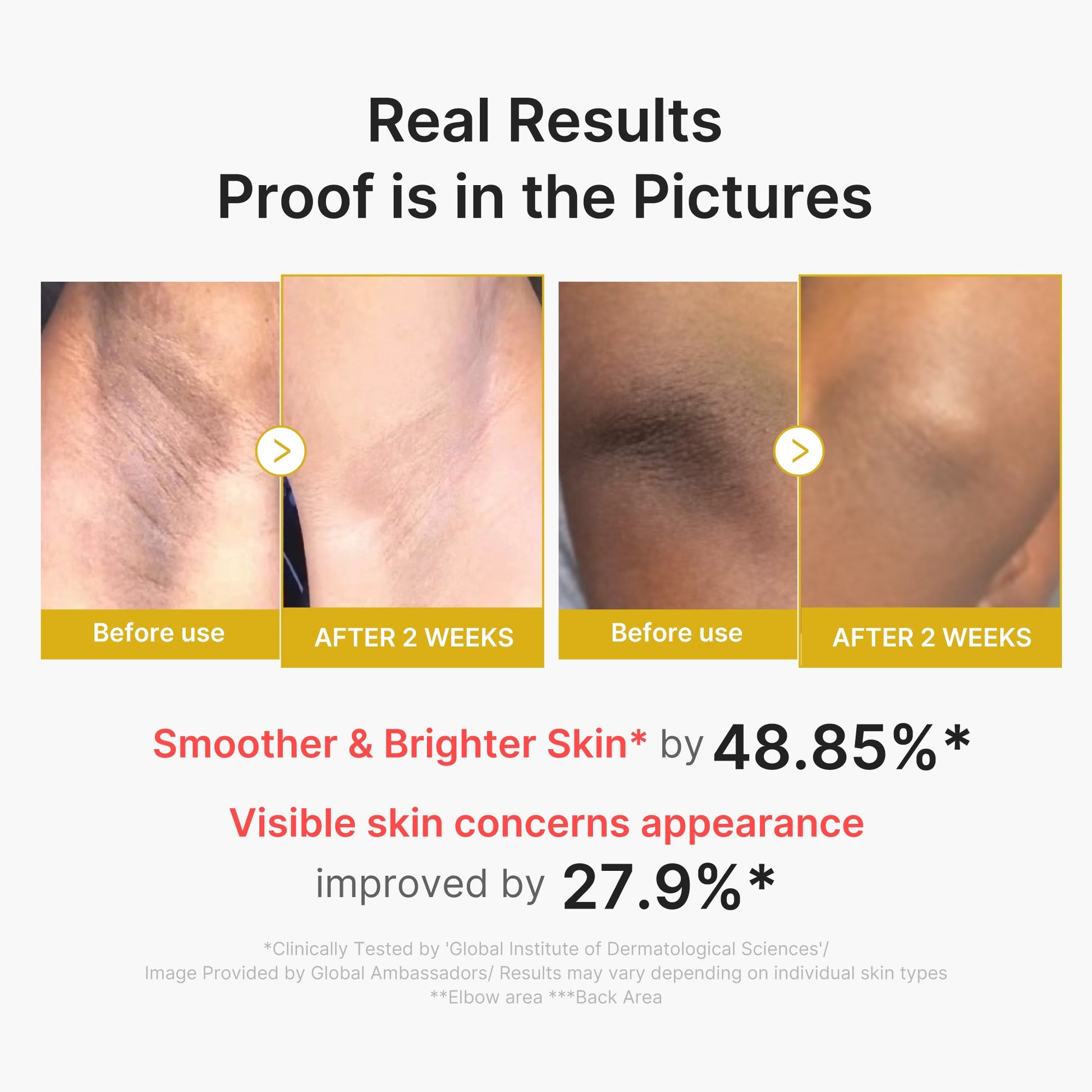 kojic-acid-turmeric-body-peel-shot-z7 02_72880cfc-382b-440b-8152-7e3dce87da2a.jpg