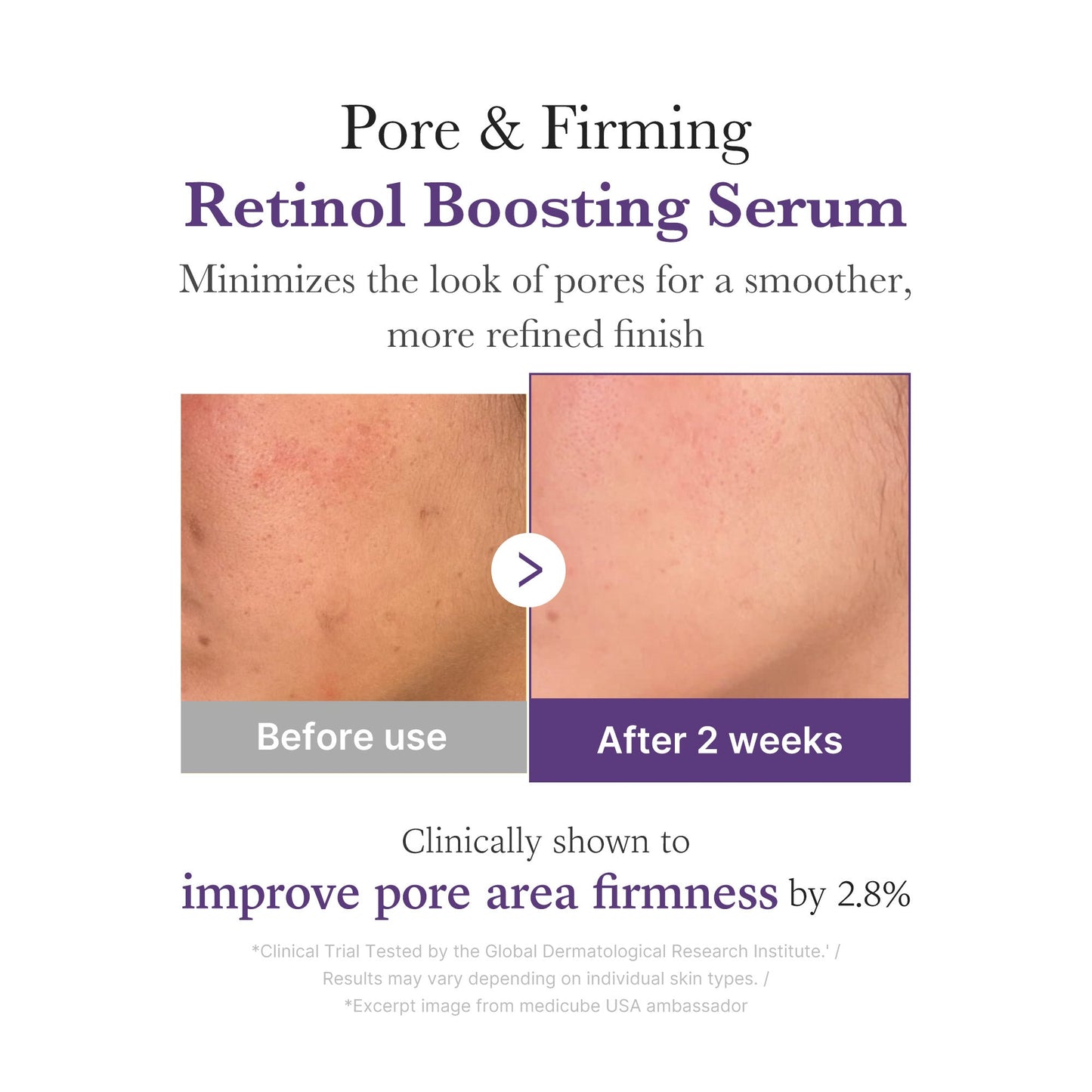 retinol-nmn-boosting-serum-x4 03_3510e7a5-5633-4a18-81ea-1389593bd517.jpg