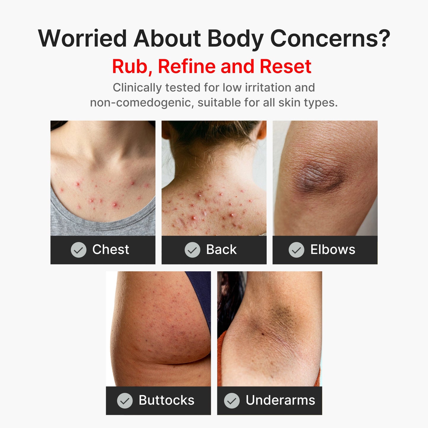 kojic-acid-turmeric-body-peel-shot-z7 04_8a7237f2-3ebf-401e-bd85-54841aeb3efc.jpg