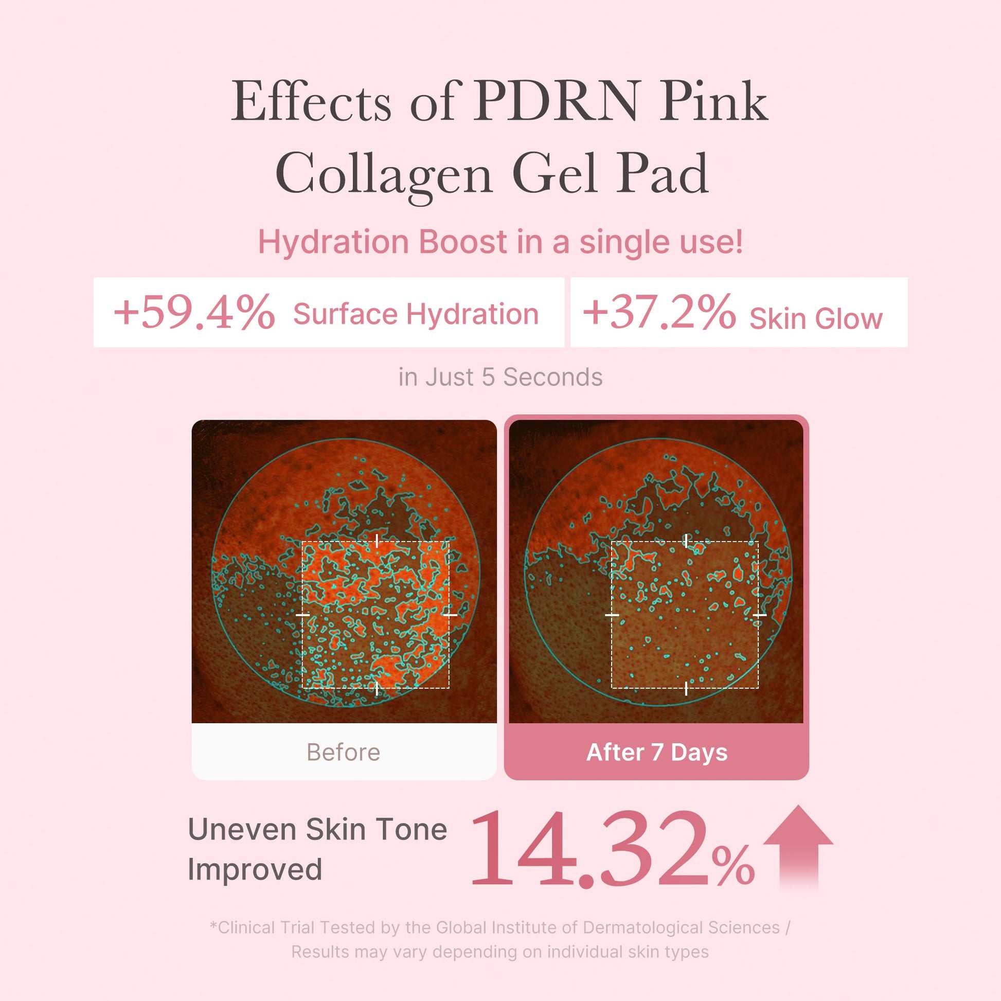 pdrn-pink-collagen-gel-toner-pad-v4 PDRN_04_f9a16a56-8d9e-4c47-a635-ed34ec3ed571.jpg
